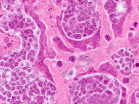 Ricerca dei parassiti in una persona