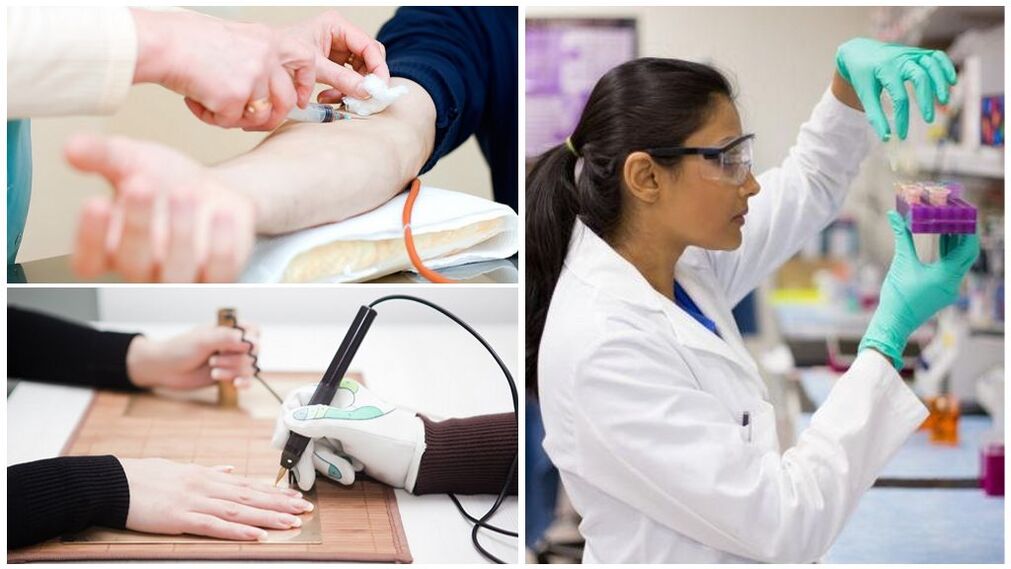 Metodi diagnostici per rilevare i parassiti nel corpo