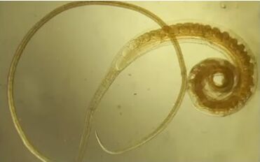 Tricocefali