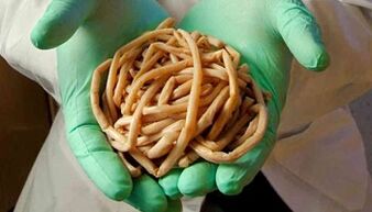 Metodi di eliminazione dei parassiti dal corpo