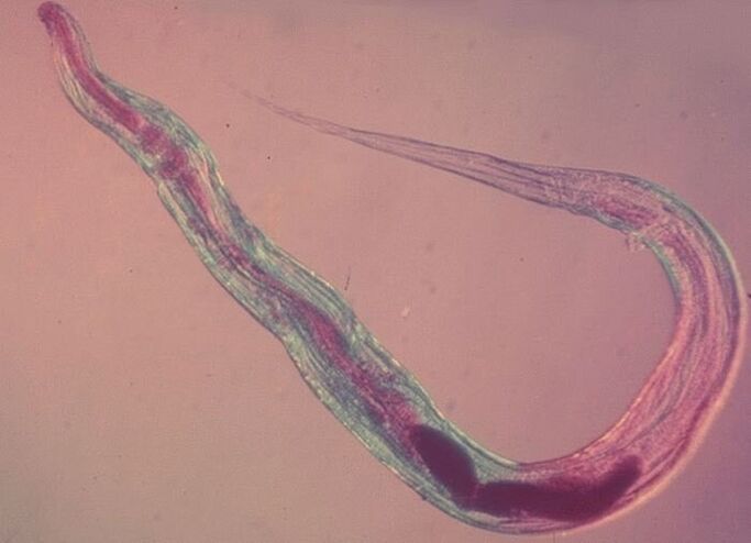 Ossiuri al microscopio