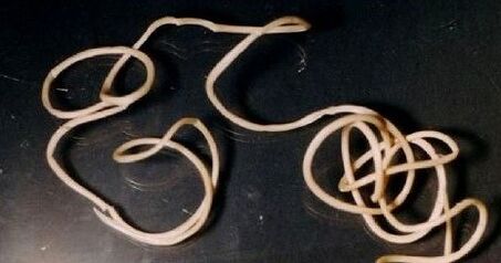 Guinea worm