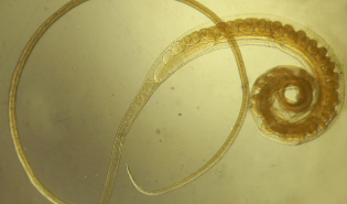 Trihozefalez trichuris trichiura